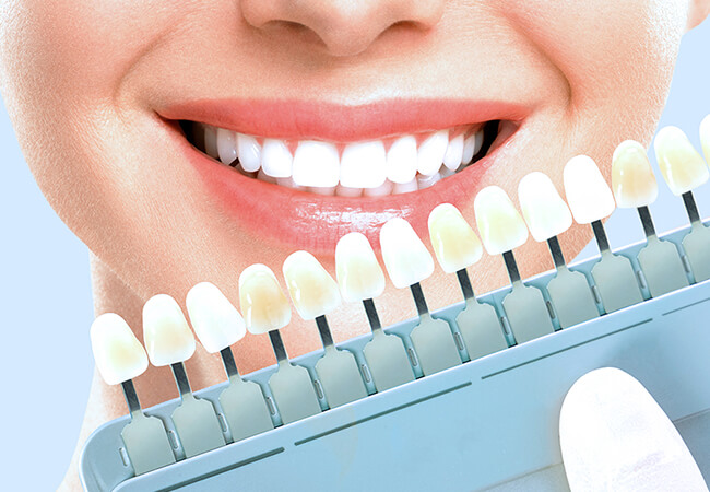 審美歯科・ホワイトニング