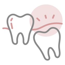 親知らずを抜きたい