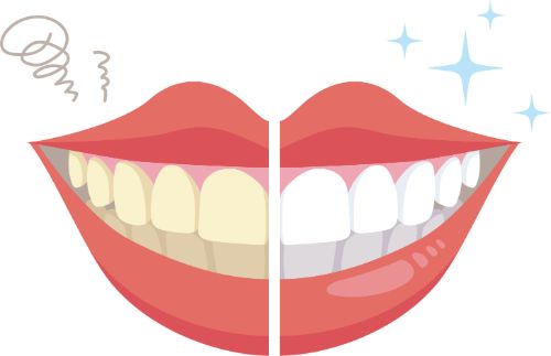 ホワイトニング