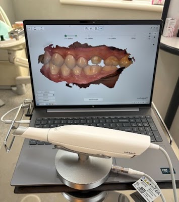ー新しい型取りシステム「トリオス」ー
